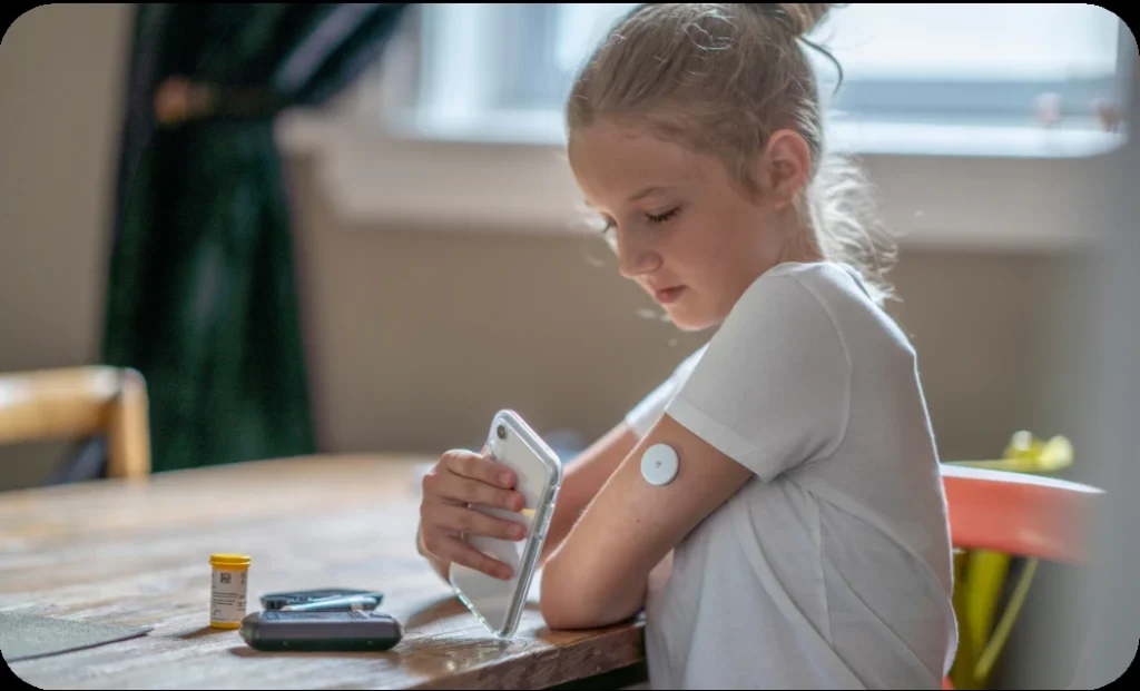 Criança utilizando sensor de glicose no braço com leitor digital, representando monitoramento moderno do diabetes infantil.